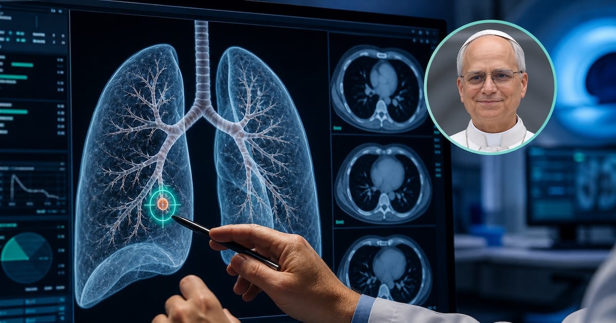 El nódulo pulmonar de tres milímetros que preocupa a León XIV y por qué los especialistas piden no alarmarse
