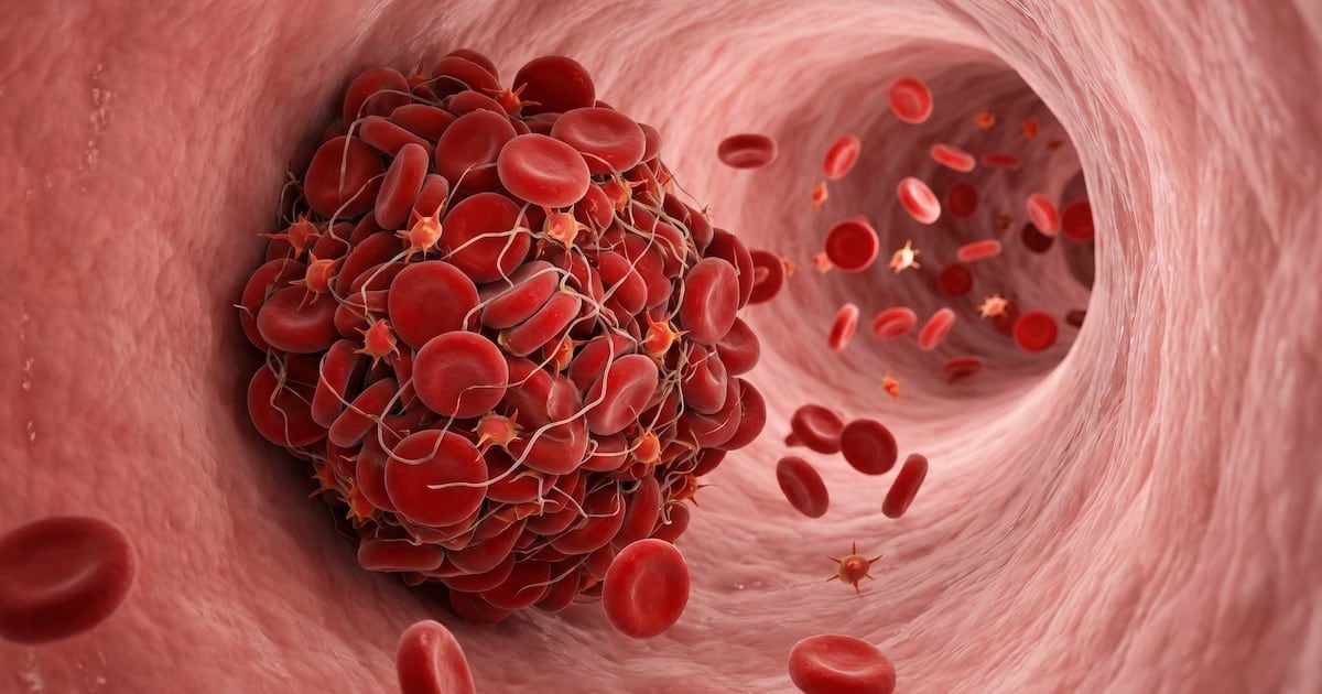 Cuando la sangre se espesa: las señales que el cuerpo avisa y que muchos dejan pasar